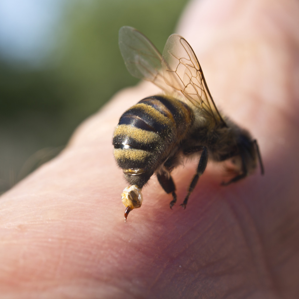 bee-sting-pest-control